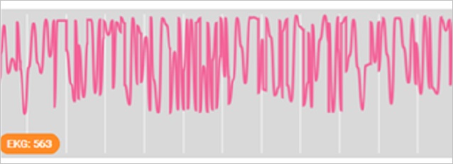 Body electrical waves graph